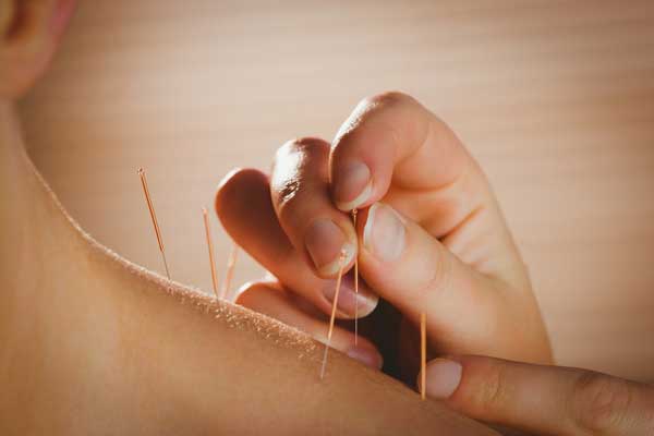 Akupunktur - Naturheilpraxis für TCM, Akupunktur, Massage